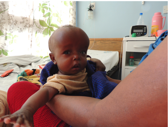 Meet sweet Joseph in Tanzania, whose treatment was funded by 44 Watsi donors including Joshua Kerney!
